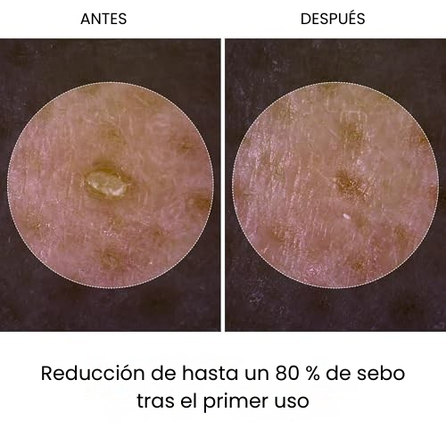 Dr. Melaxin EXFOLIANTE PEEL SHOT DE ARROZ NEGRO