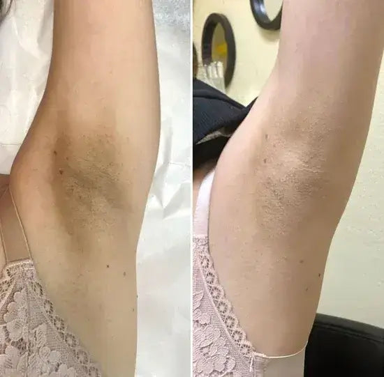 Peel Shot – Spray Corporal Exfoliante con Ácido Kójico y Cúrcuma